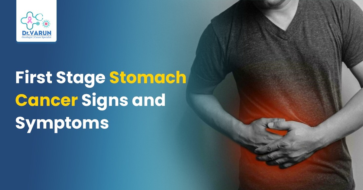 First Stage Stomach Cancer Signs and Symptoms